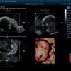 ULTRASONIDO Z6 PORTATIL DOPPLER 4D (2)