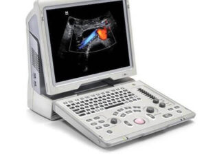 ULTRASONIDO Z6 PORTATIL DOPPLER 4D TRANSDUCTOR CONVEXO Y ENDOCAVITARIO MINDRAY